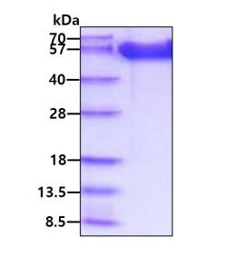 3 μg by SDS-PAGE under reducing condition and visualized by coomassie blue stain